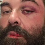 Homem é agredido após reclamar de som alto em igreja no litoral de SC