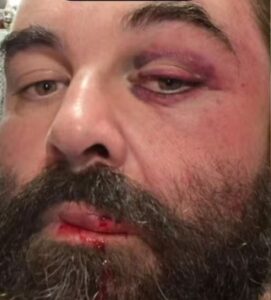 Homem é agredido após reclamar de som alto em igreja no litoral de SC